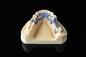 Medizinischer Drucker-Adjustable Thickness Digital-Drucker Zahnheilkunde SLM 3D