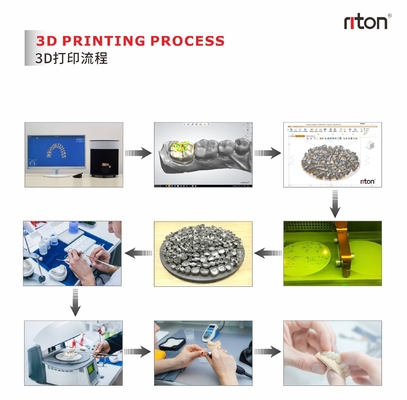 Riton M-150D Dental Industrial Metal 3D-Drucker / additive Fertigungsmaschine / medizinische SLM-Laser-Schmelzmaschine / CNC-Metallverarbeitungsmaschine