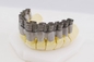 20μM High Speed Crown klammert medizinische Light Curing For-Zahnheilkunde des Drucker-3D ein