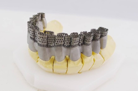 Drucker Special Printing Equipment Riton Dentals 3D für keramische fixierte Metallinnere Krone